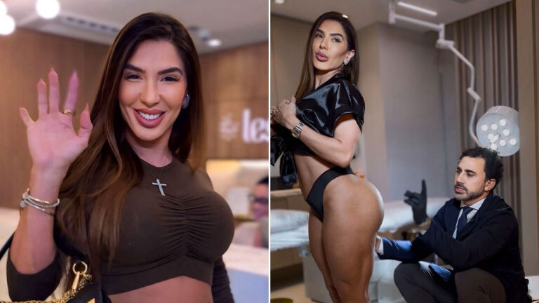 Andrea de Andrade sorrindo à esquerda e posando com o médico Roberto Chacur durante revisão de tratamento estético à direita