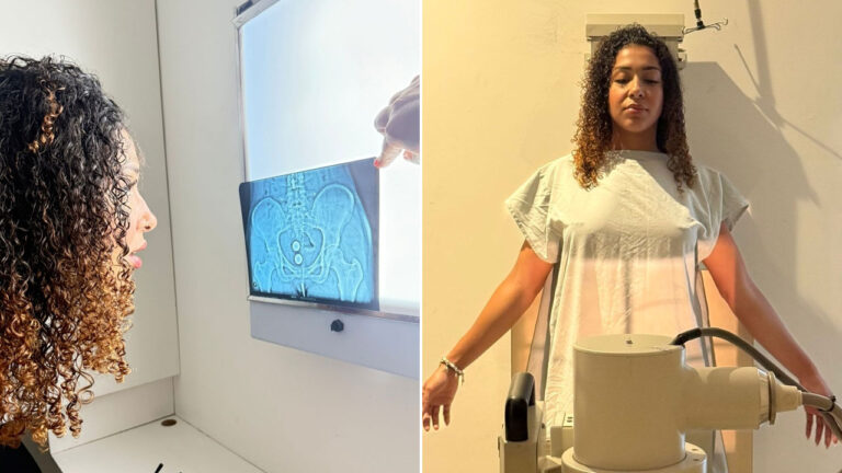 Emelly Souza observa um exame de raio-x da região pélvica e aparece posicionada em frente a um equipamento médico usando avental hospitalar branco