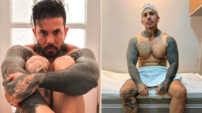 Montagem do influenciador Arthur O Urso, à esquerda agachado com braços tatuados em evidência e à direita sentado em maca médica usando touca branca