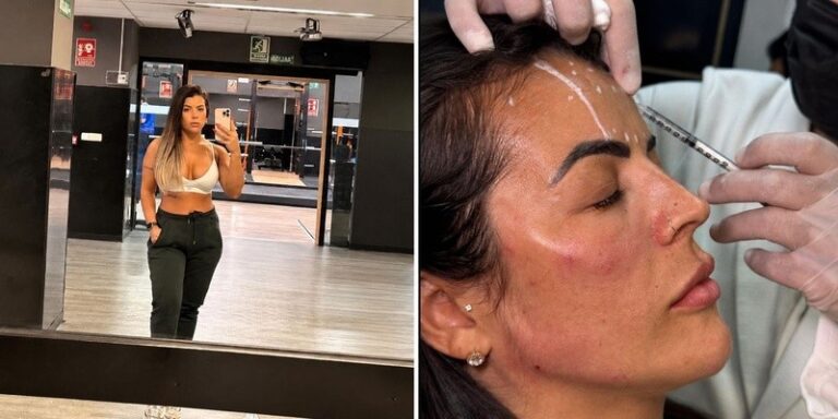 Rosana Ferreira posa em selfie na academia e aparece recebendo aplicação estética no rosto em clínica dermatológica