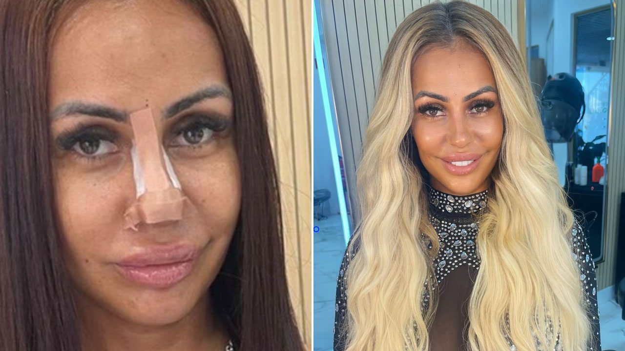 Débora Dunhill em duas fotos lado a lado, uma mostrando curativo no nariz e outra com cabelo loiro solto e maquiagem completa em ambiente de salão de beleza