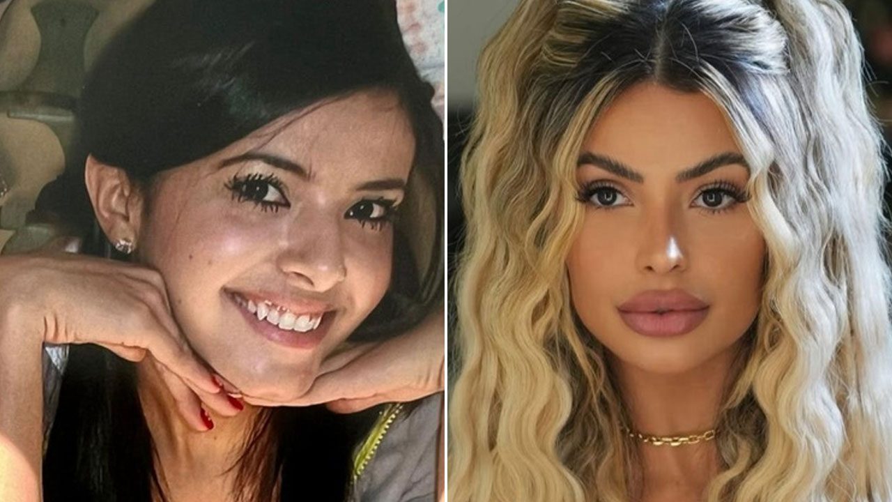 Montagem mostra Janaína Prazeres com cabelos pretos antes de procedimentos estéticos e atualmente com fios loiros e ondulados