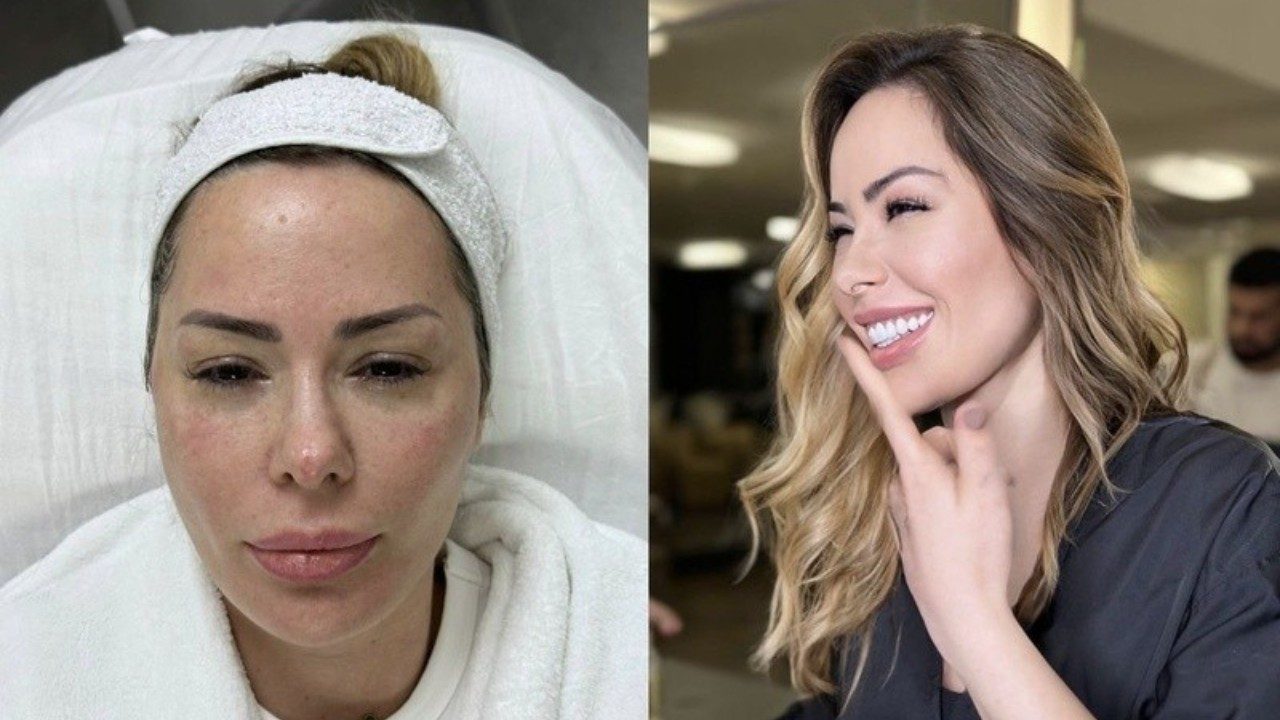 Ju Isen sem maquiagem e com faixa na cabeça em clínica estética ao lado de foto sorrindo em ambiente interno