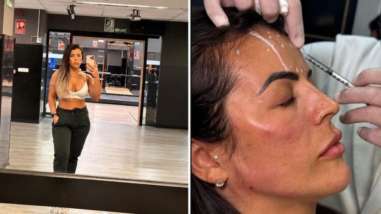 Rosana Ferreira posa em selfie na academia e aparece recebendo aplicação estética no rosto em clínica dermatológica